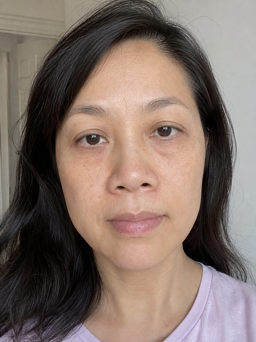 Before routine Beauty Kiwi customer image