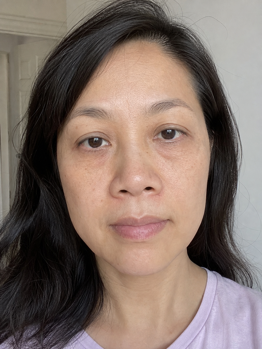 Before using Collagen Plump Repair Multibalm, showing visible dryness and fine lines