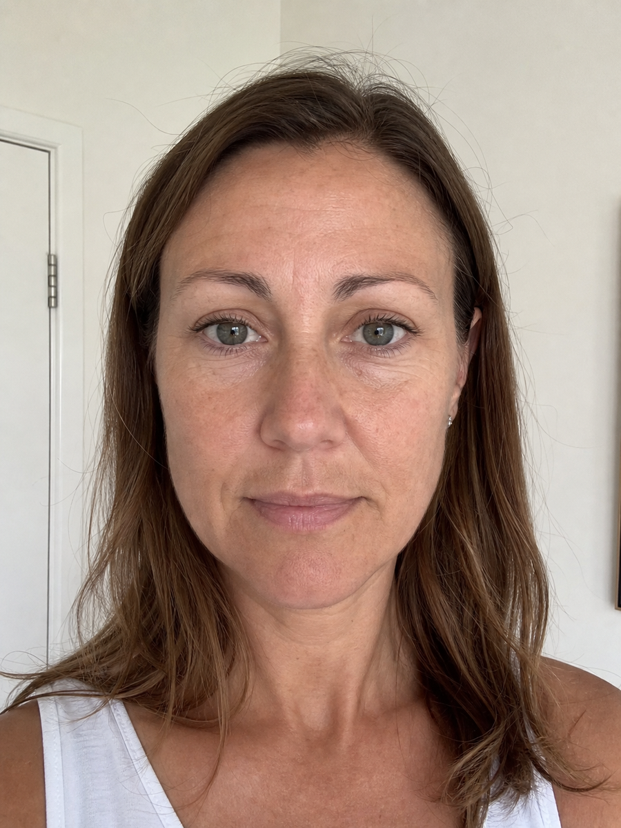 Before using Collagen Plump Repair Multibalm, showing fine lines and less firm-looking skin