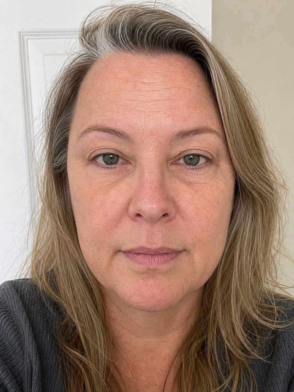 Before routine Beauty Kiwi customer image